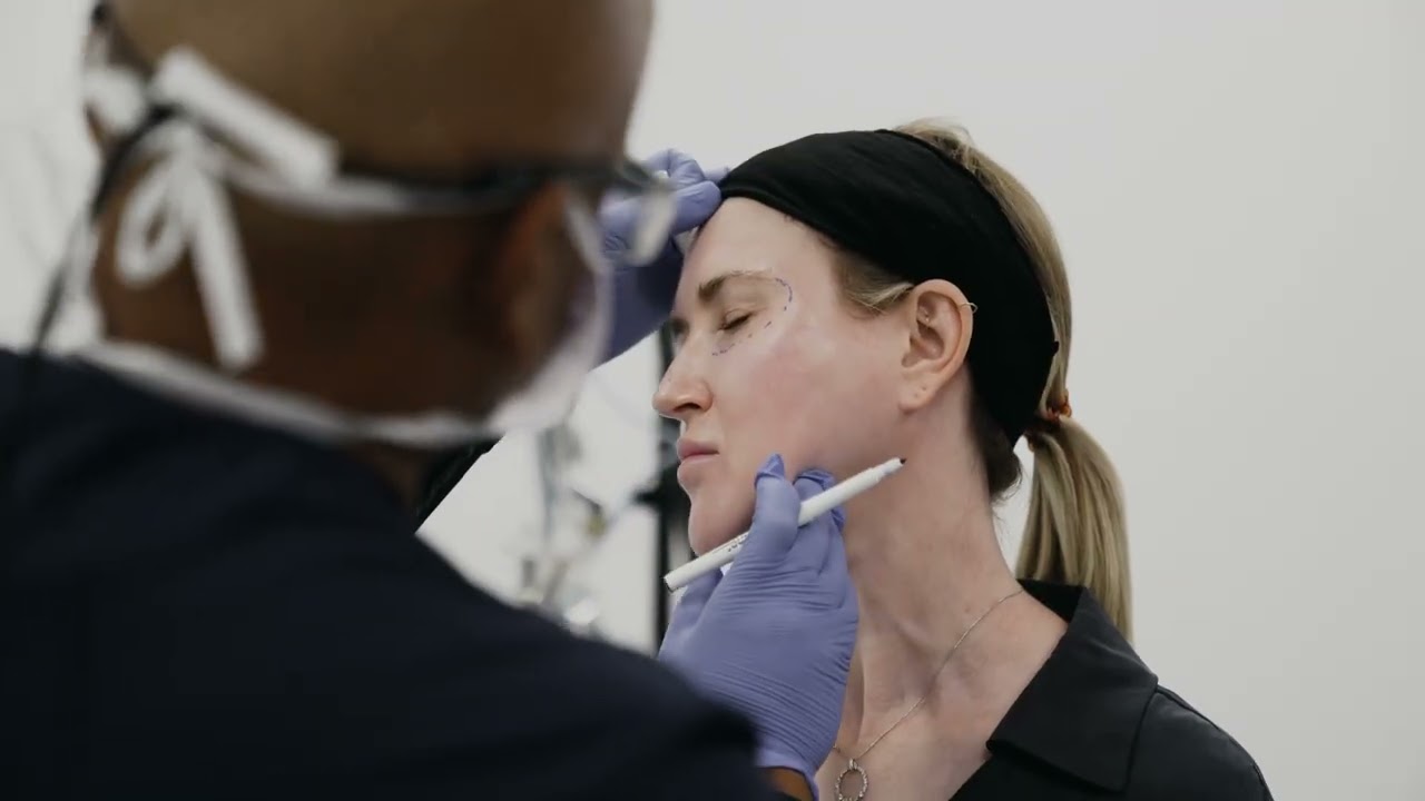 C02 Laser Treatments by Dr Shobhan Manoharan